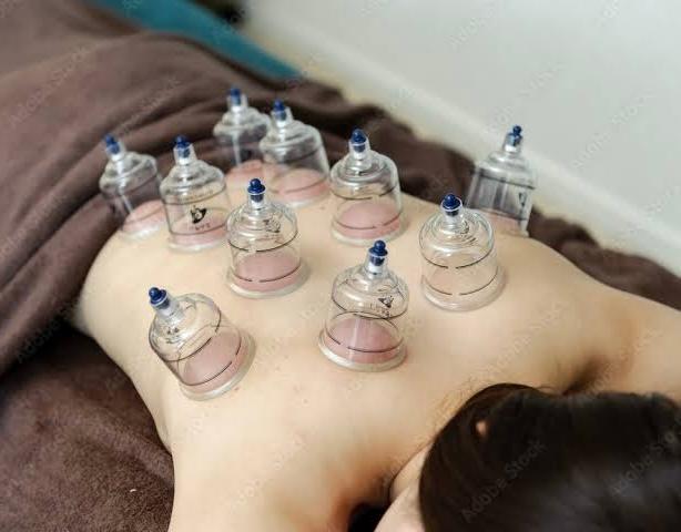 全身骨格筋調整＋カッピング 