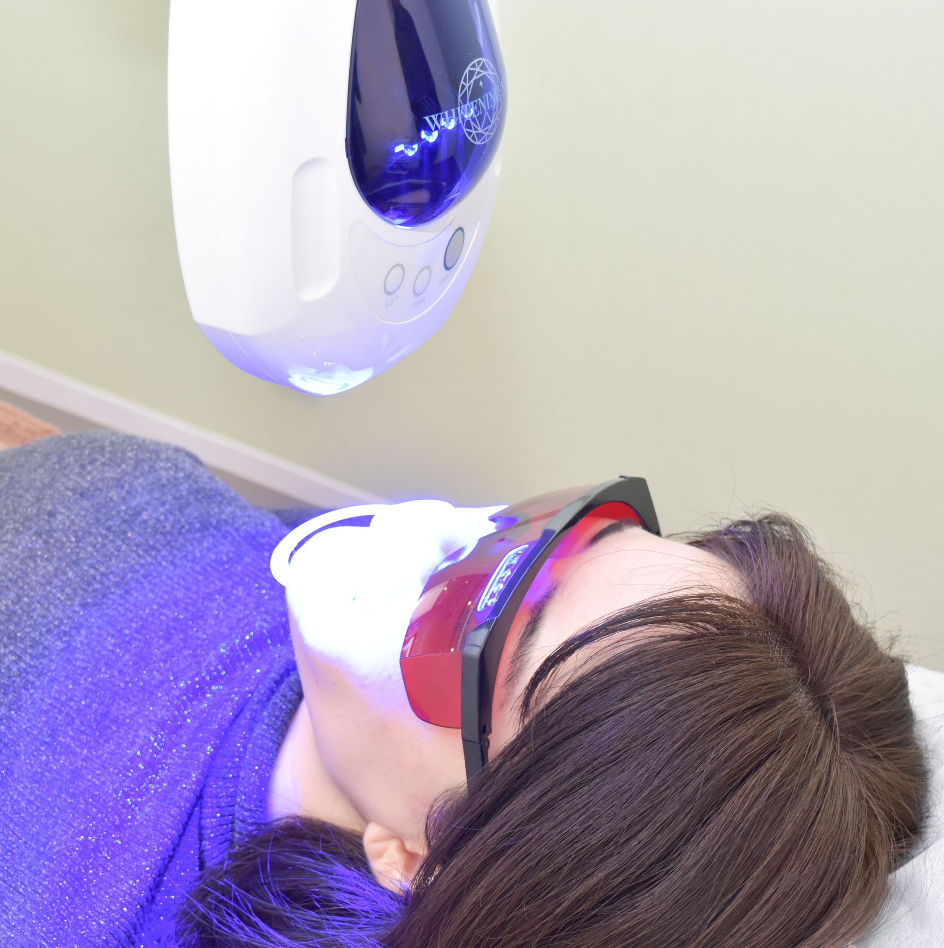 【セルフホワイトニング(2回目以降）】業界最新機器　平均4回目で実感