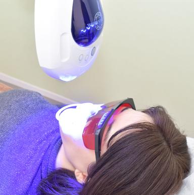 【セルフホワイトニング(2回目以降）】業界最新機器　平均4回目で実感