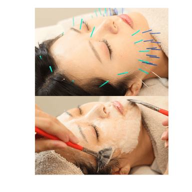 【韓国人のような水光肌へ】美容鍼100本＋ララピール15,400円