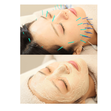 【１周年記念キャンペーン】美容鍼＋ハーブピーリング￥9900→￥8900