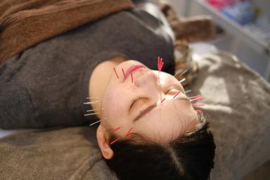 【新規限定】カウンセリング＋美容整体30分＋美容鍼30分 通常料金13,200円