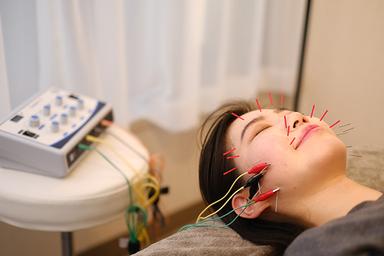 【新規限定】カウンセリング＋美容鍼 60分 通常料金13,200円