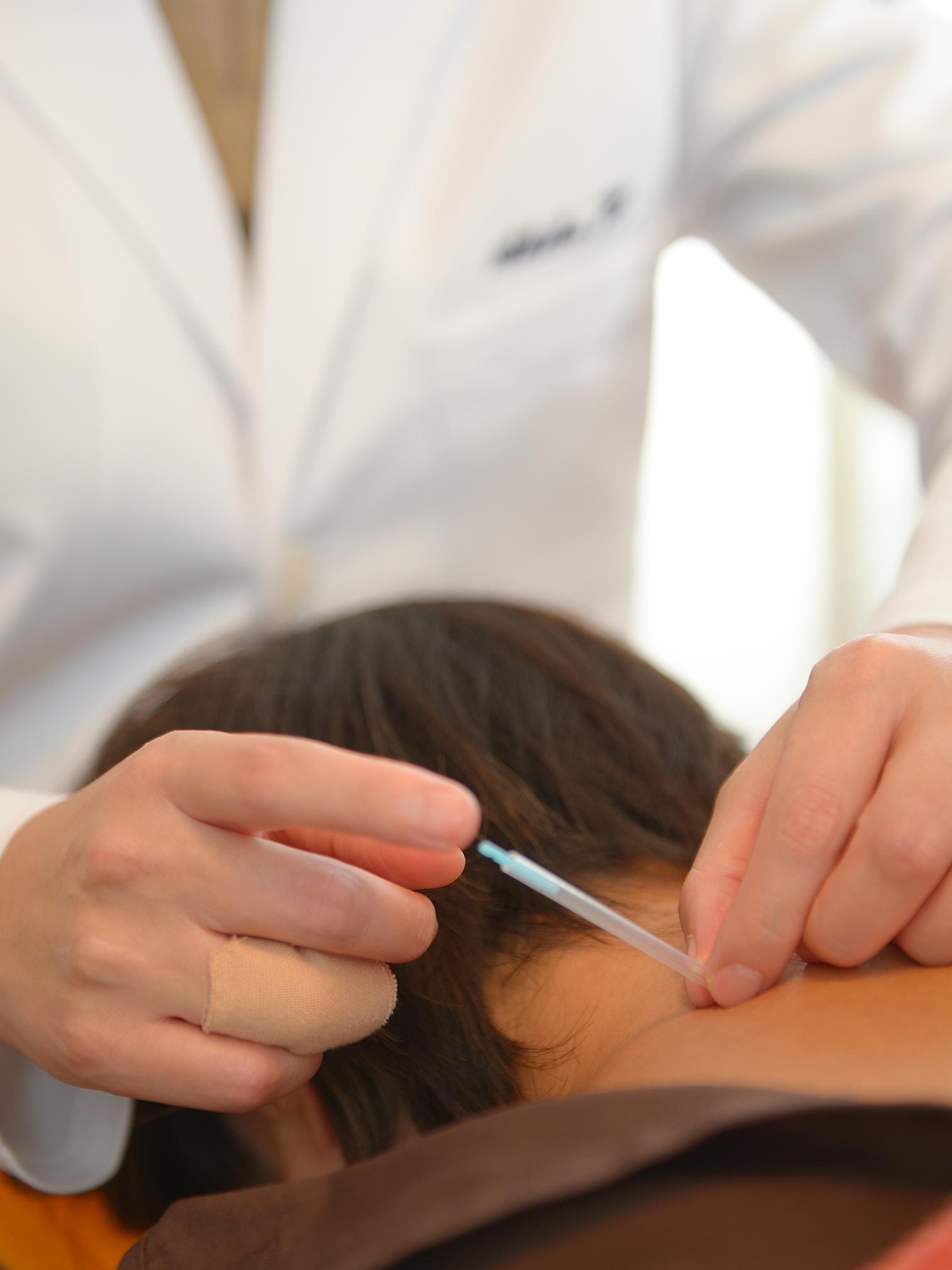 鍼施術「肩こり」でお悩みがある方へ 30分