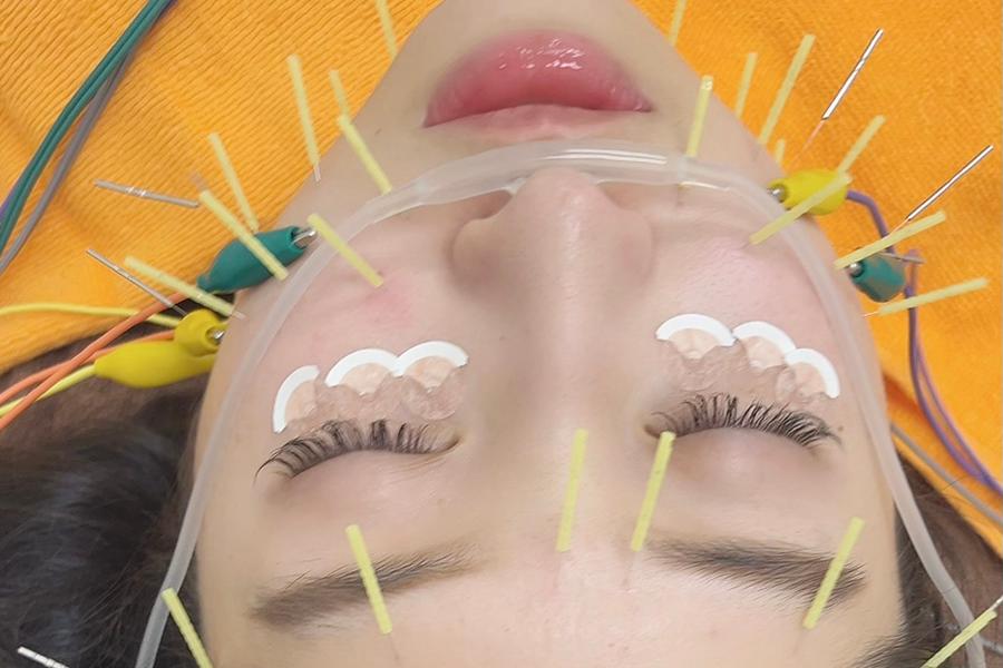 【新規限定】《鍼が初めての方へ》お試しトールコース ※美容鍼 60分 通常料金11,000円