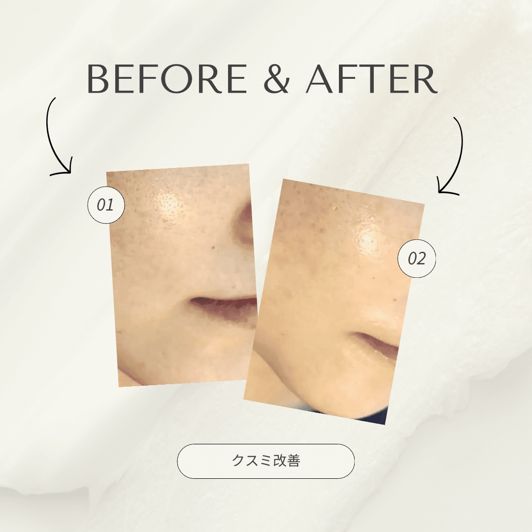 《Face 》くすみ改善コース(オプション2種使用)  90分