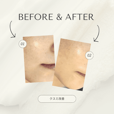 《Face 》くすみ改善コース(オプション2種使用)  90分
