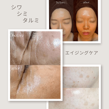 【新規限定】《Face 》しみ・しわ・たるみ改善コース90分 通常料金24,200円