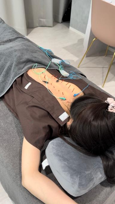 自律神経調整鍼｜不眠/気分の落ち込み/首痛/頭痛/疲労感　￥15,400→￥4,980