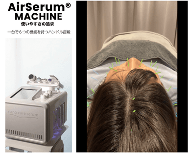 【新規限定】輪郭美人鍼×Air Serum 通常価格37,180円(※幹細胞導入は別途7,260円かかります)