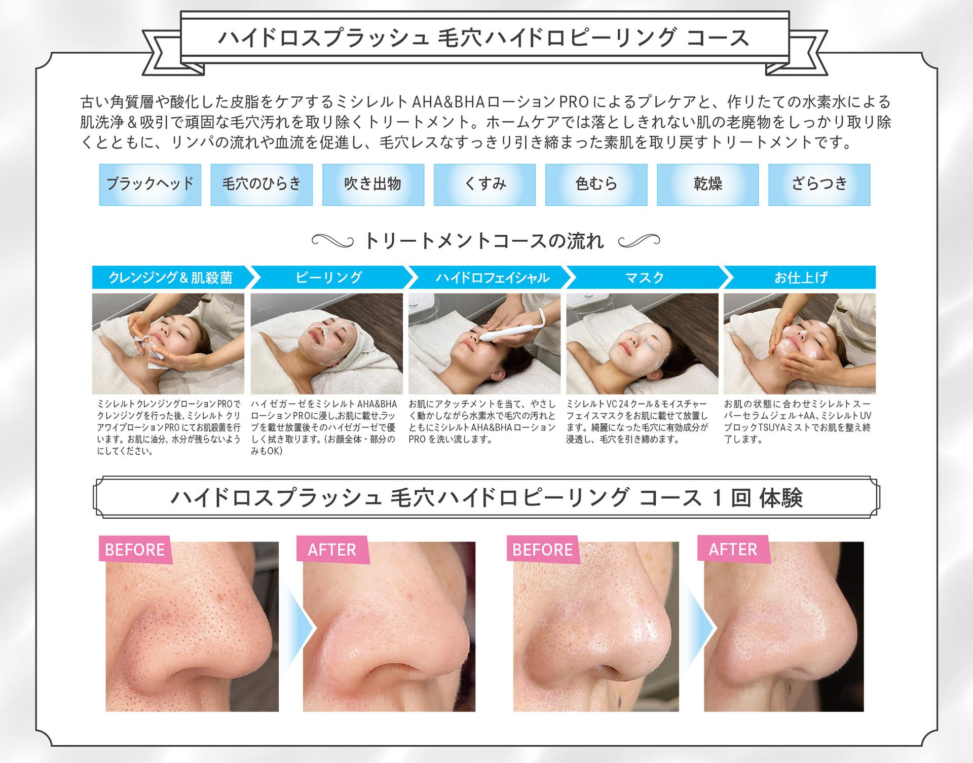 毛穴の汚れ、ざらつき【ハイドロピーリング】