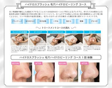 毛穴の汚れ、ざらつき【ハイドロピーリング】