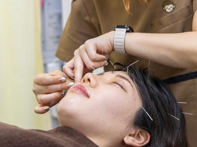 【おすすめ】美容鍼灸＋身体のオプション 60分