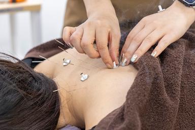 【おすすめ】鍼灸お任せ45分