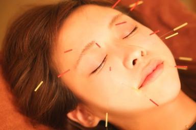 美容鍼灸＋顔のオプション 60分