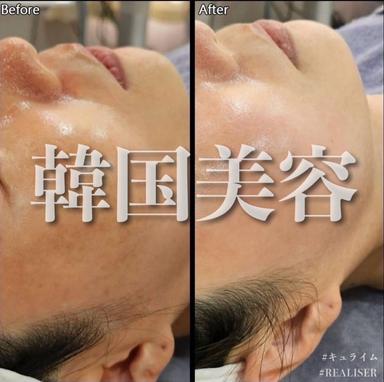 【都度】韓国美容基礎