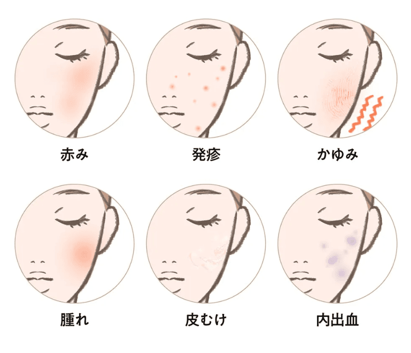 アフターコンディショニングケア（クリニック後のケア）