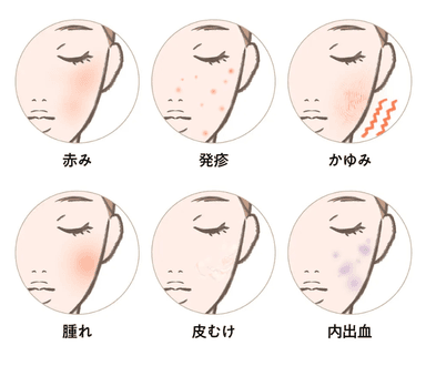 アフターコンディショニングケア（クリニック後のケア）