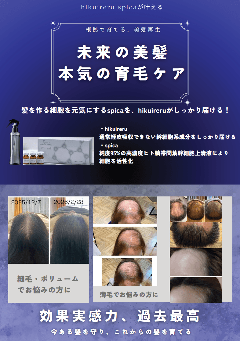 NAG式'発毛’術⚡️NK細胞原液＋ヒト臍帯間葉幹細胞培養液 プラズマ導入（全体）