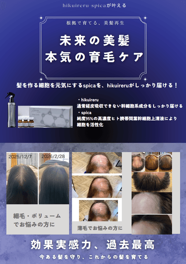 NAG式'発毛’術⚡️NK細胞原液＋ヒト臍帯間葉幹細胞培養液 プラズマ導入（全体）