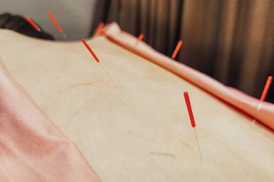 【新規限定】肩こり腰痛など身体の痛み、お疲れに！手技×鍼灸で深層のコリ感までしっかりアプローチ★ボディマッサージ＋鍼灸 60分