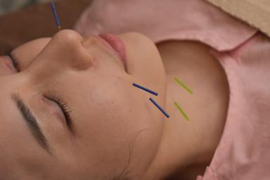【効果実感！】美容鍼+ドライヘッドスパ 60分