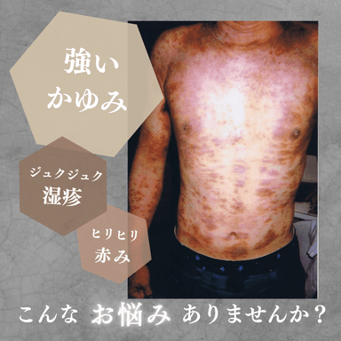 体質改善重症者専用コース120分　