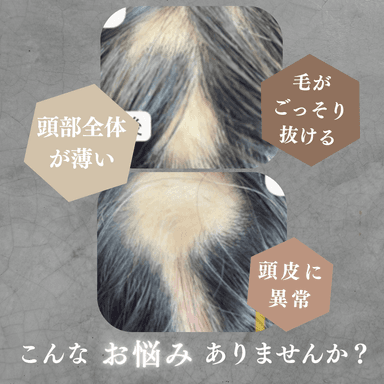 【新規限定】脱毛症体質改善コース 60分 通常料金16,800円