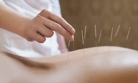 Deep Tissue with Acupuncture 90分