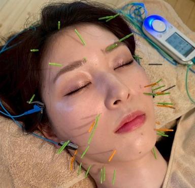 【新規限定】美容鍼＆ヘッドor電気鍼体験コース ９０分コース通常料金16,500円