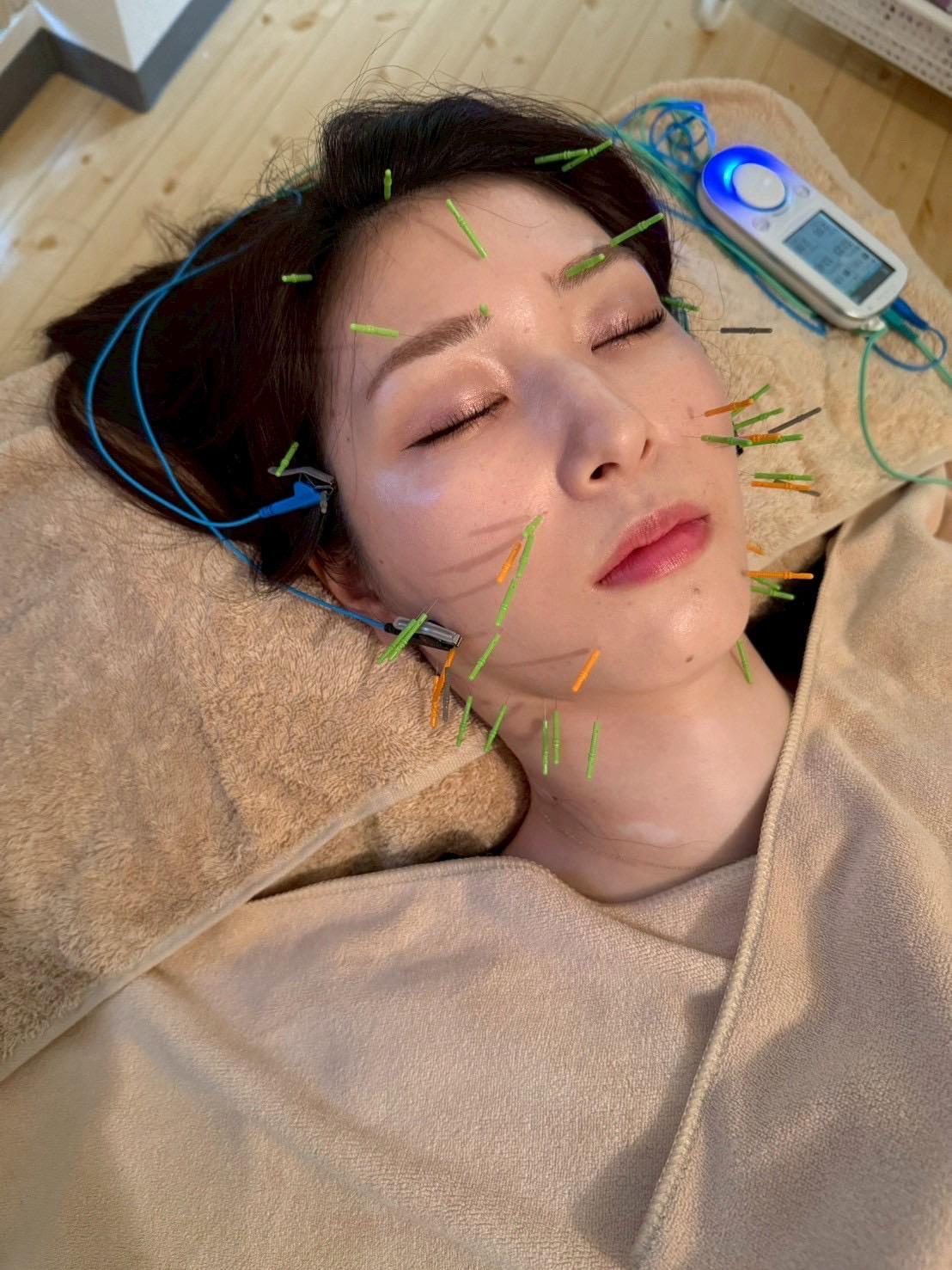 【新規限定】美容鍼＆ヘッドor電気鍼９０分コース通常料金16,500円