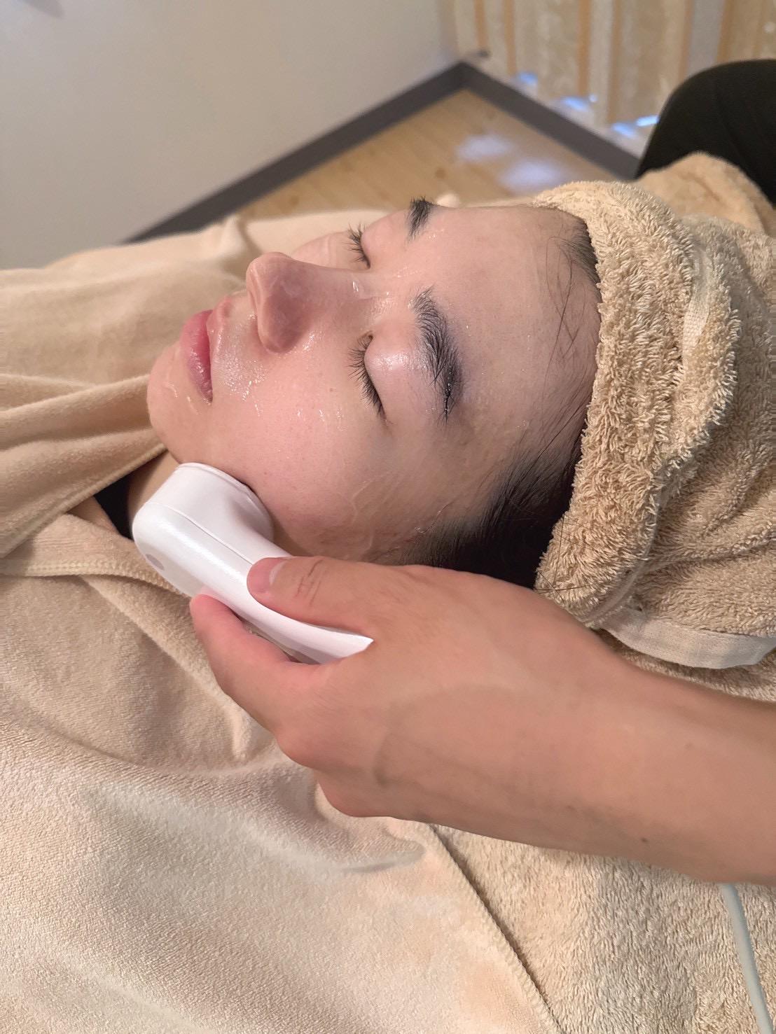 【新規限定】美容鍼&イオン導入【たるみしわ・ニキビ痕シミ・ニキビ乾燥・二重顎・むくみ】通常料金24,500円