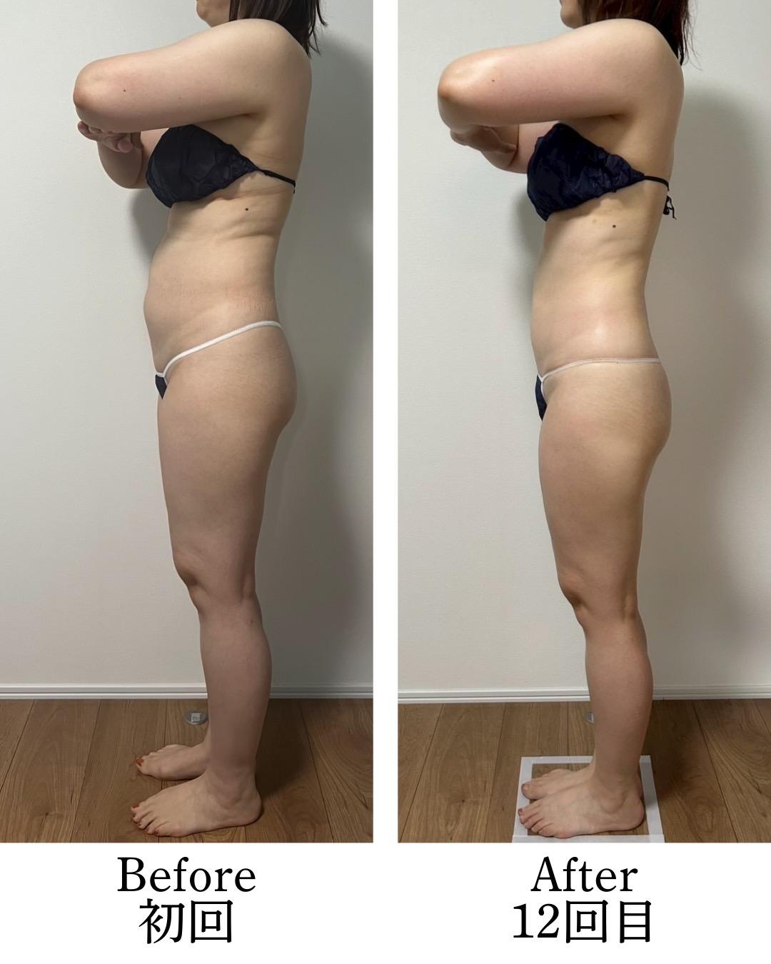 【新規限定】脂肪撃退セルゼロ全身コース　90分 通常料金30,800円