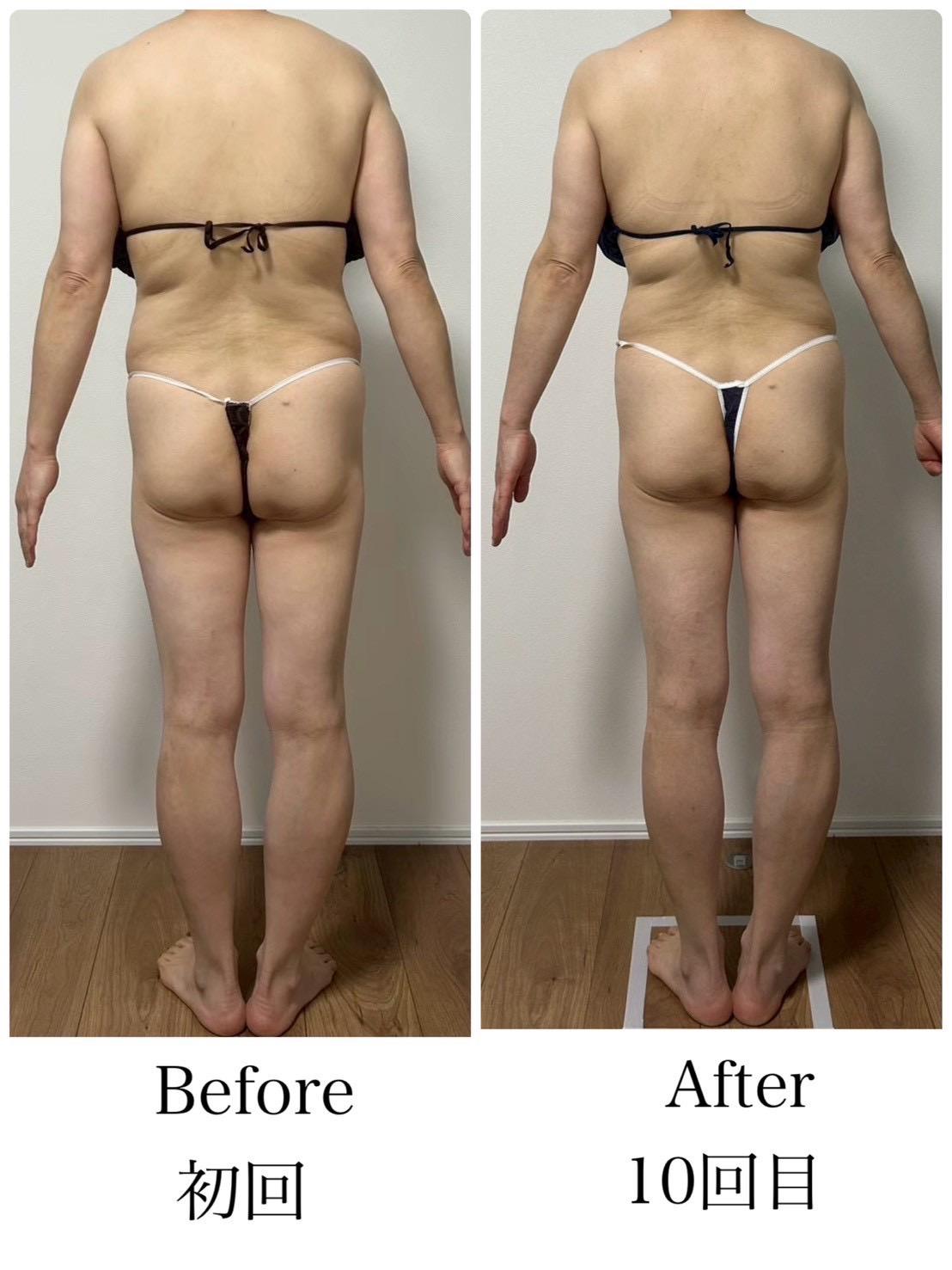 【新規限定】体質改善・脂肪燃焼セルゼロ＋トーンヌール全身コース 100分 通常料金39,300円