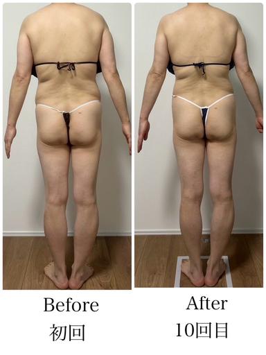 【新規限定】体質改善・脂肪燃焼セルゼロ＋トーンヌール全身コース 100分 通常料金39,300円