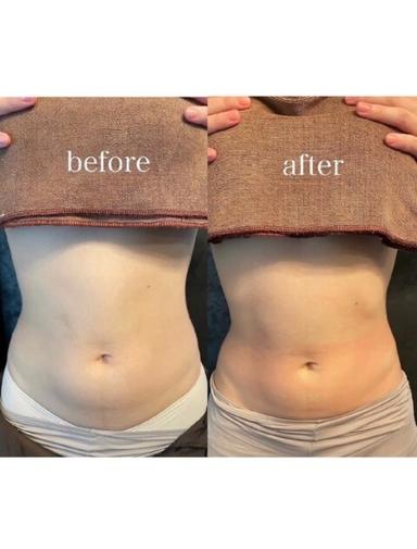 【美くびれ×腸活】お腹・背中・ウエスト集中ケア60分※カウンセリング10分含む