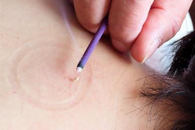 お灸施術【身体の痛み・不調に】はじめての方にもお勧め◎ 60分
