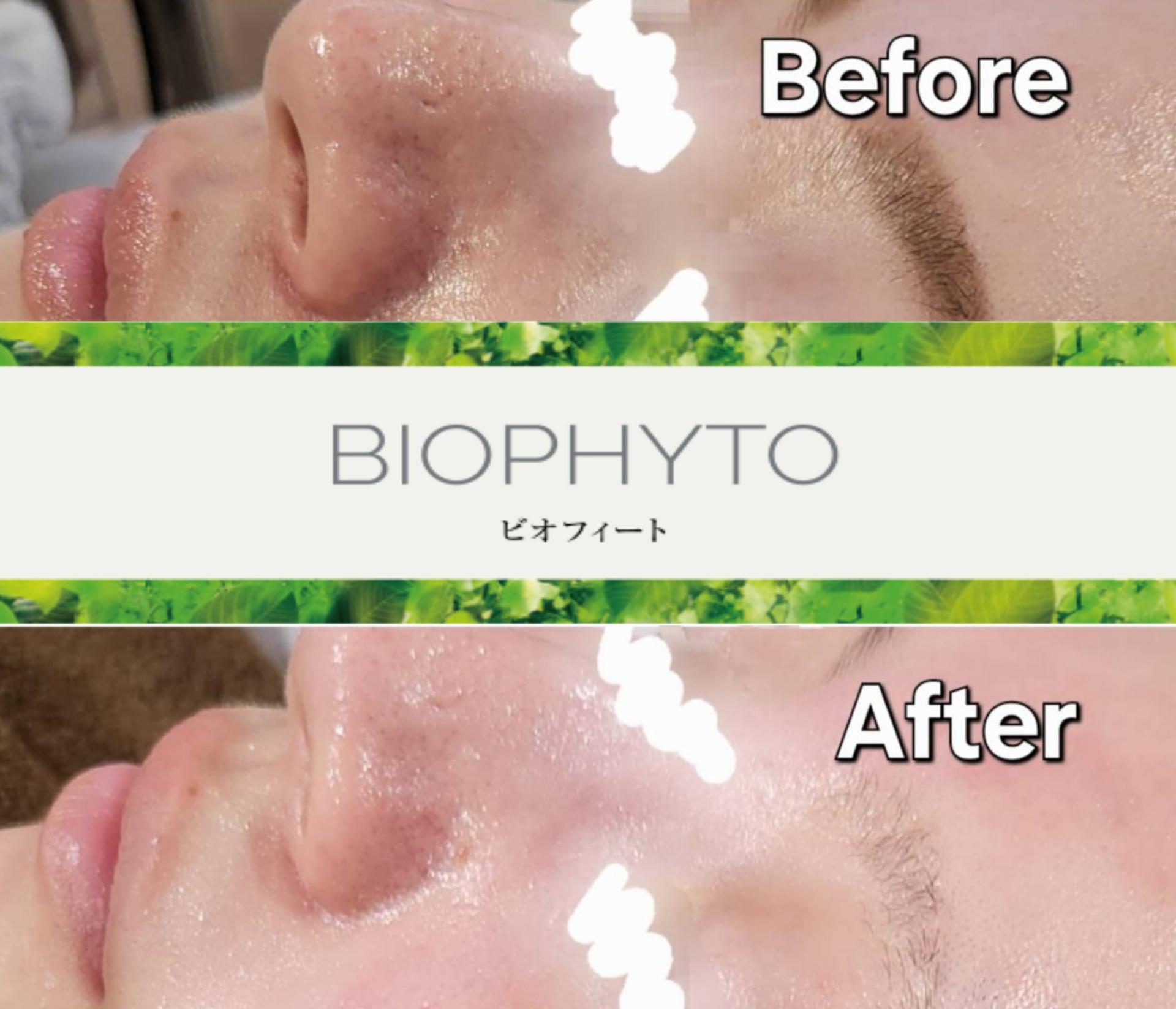 【ハーブで毛穴つるん】クリスティーナ ビオフィート  120分 通常料金13,200円