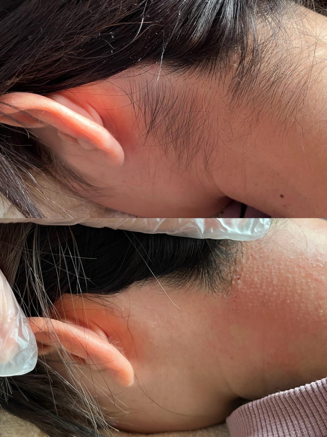 【うなじwax 】30分