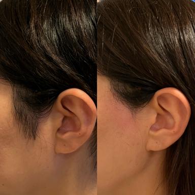 【もみあげwax 】15分