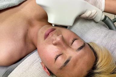 光と高周波ダブルで綺麗☆【E-light光フェイシャル】 40分