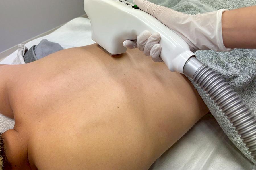 上半身脱毛(表or裏) 40分