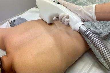 上半身脱毛(表or裏) 40分