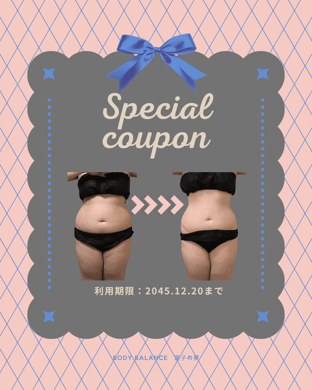 お腹の厚み・はみ肉改善！【1周年記念第2弾】