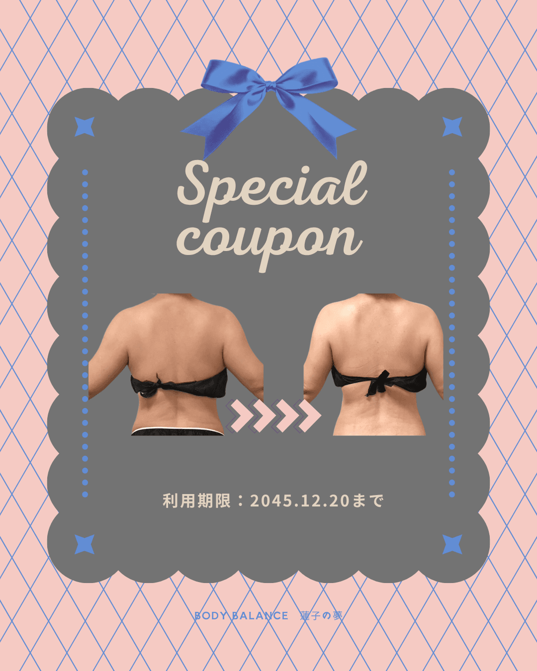 ふりそで肉×背中すっきりケア！限定１５名【１周年記念第２弾】