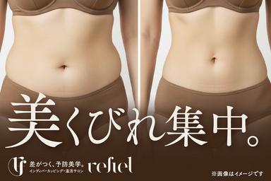 【全員OK】【8月限定】夏の美ボディ応援！インディバ30分 くびれ集中ケア