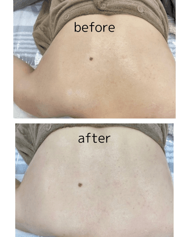 【新規限定】HAABREPRO背中ハーフ