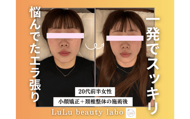 【会員の方】コース後の特別価格《セレクト3コース》