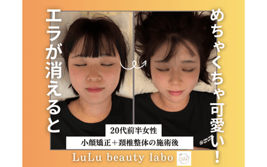 【中顔面短縮/エラ張りに】小顔矯正&頚椎整体《80分コース》¥13,200→¥6,600