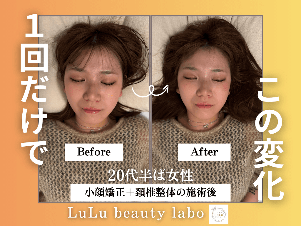 【28日～31日限定!】小顔矯正&美容整体《全身120分コース》¥22,000→¥8,900